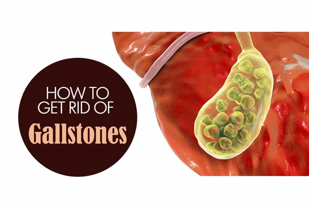 Gallstones Natural Treatment Fedon